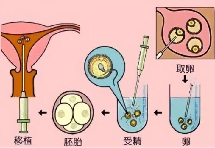 试管供卵代孕男孩全包